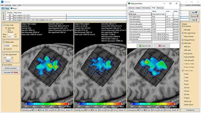 TMSmap – Software for Quantitative Analysis of TMS Mapping Results